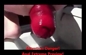 Experimental anal fisting