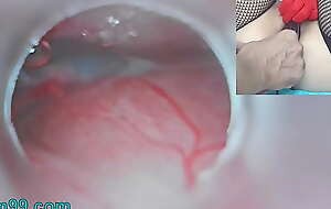 Uncensored Japanese Insemination with Cum into Uterus and Endoscope Camera by Cervix involving watch dominant womb