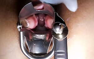 Observe the inside orgasm's vagina by opening it alongside a speculum