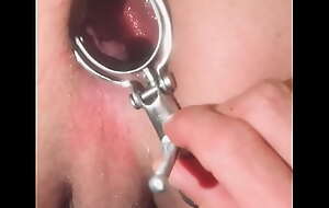 My pink gaping hole stretched with a speculum